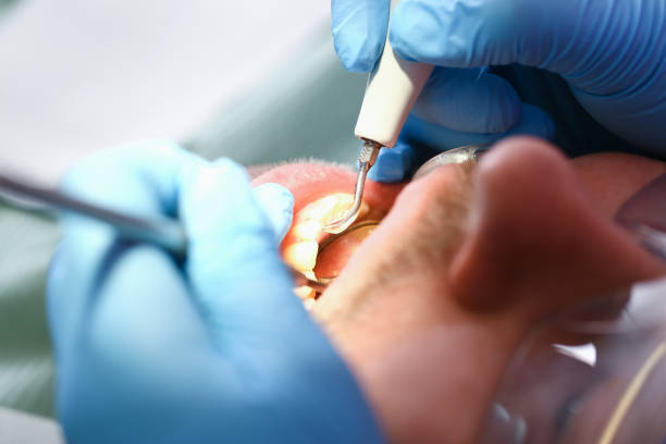 Best Weekend Emergency Dentist in White Hall, IL